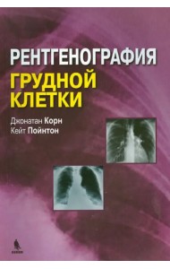 Рентгенография грудной клетки