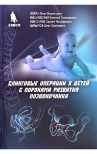 Слинговые операции у детей с пороками развития позвоночника