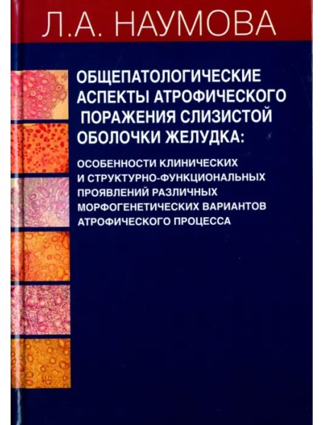 Общепатологические аспекты атрофического поражения слизистой оболочки желудка