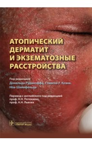 Атопический дерматит и экзематозные расстройства