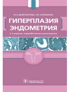 Гиперплазия эндометрия