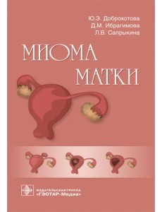 Миома матки. Руководство