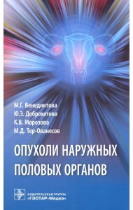 Опухоли наружных половых органов