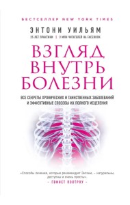 Взгляд внутрь болезни. Все секреты хронических и таинственных заболеваний