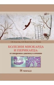 Болезни миокарда и перикарда. От синдромов к диагнозу и лечению
