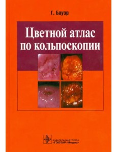 Цветной атлас по кольпоскопии