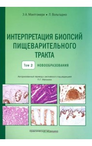 Интерпретация биопсий пищеварительного тракта. Том 2. Новообразования