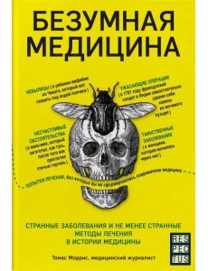Безумная медицина. Странные заболевания и не менее странные методы лечения в истории медицины Безумная медицина. Странные заболевания и не менее странные методы лечения в истории медицины