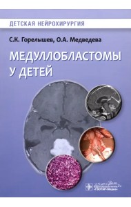 Медуллобластомы у детей. Руководство