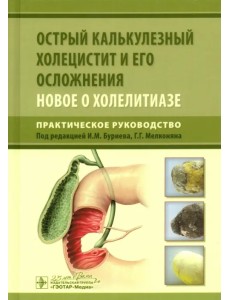 Острый калькулезный холецистит и его осложнения. Новое о холелитиазе. Практическое руководство