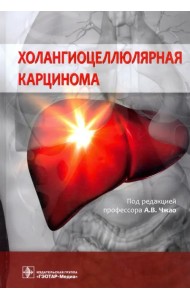 Холангиоцеллюлярная карцинома