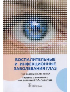 Воспалительные и инфекционные заболевания глаз Воспалительные и инфекционные заболевания глаз