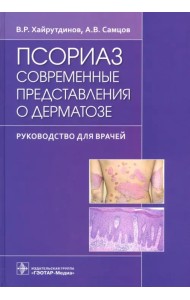 Псориаз. Современные представления о дерматозе. Руководство для врачей