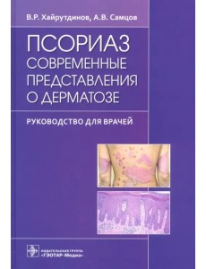 Псориаз. Современные представления о дерматозе. Руководство для врачей Псориаз. Современные представления о дерматозе. Руководство для врачей