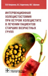 Интервенционная холецистостомия при остром холецистите в лечении пациентов старших возрастных групп