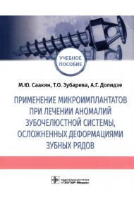 Применение микроимплантатов при лечении аномалий зубочелюстной системы, осложненных деформациями