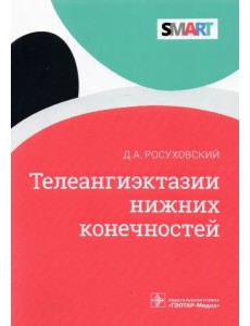 Телеангиэктазии нижних конечностей Телеангиэктазии нижних конечностей