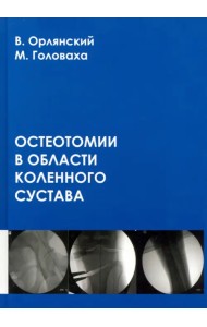 Остеотомии в области коленного сустава