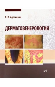 Дерматовенерология