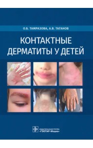 Контактные дерматиты у детей