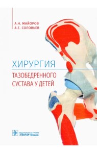 Хирургия тазобедренного сустава у детей