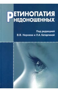 Ретинопатия недоношенных