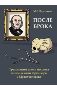 После Брока. Трепанации эпохи неолита из коллекции Прюньера в Музее Человека в Париже