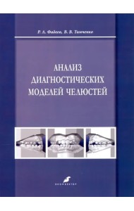 Анализ диагностических моделей челюстей