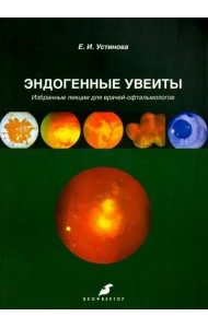 Эндогенные увеиты. Избранные лекции для врачей-офтальмологов