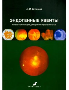 Эндогенные увеиты. Избранные лекции для врачей-офтальмологов