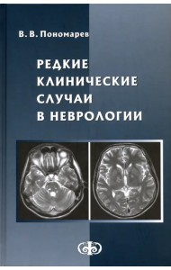 Редкие клинические случаи в неврологии (случаи из практики). Руководство для врачей