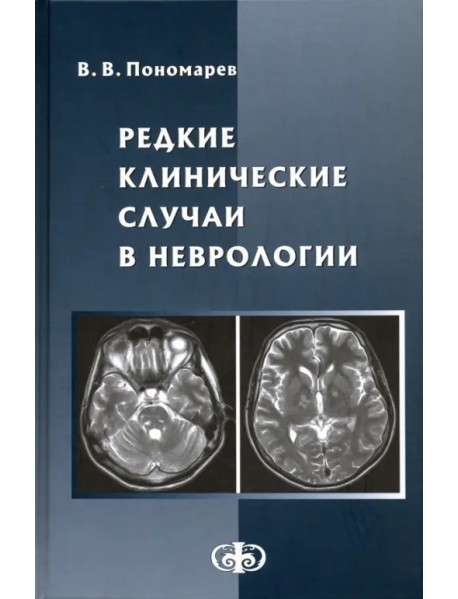Редкие клинические случаи в неврологии (случаи из практики). Руководство для врачей