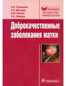 Доброкачественные заболевания матки Доброкачественные заболевания матки