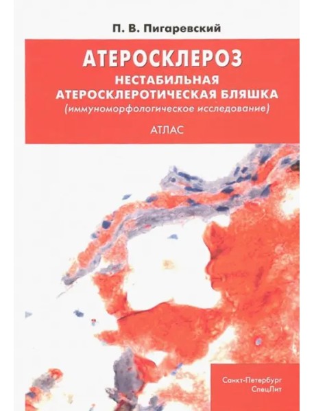 Атеросклероз. Нестабильная атеросклеротическая бляшка (иммуноморфологическое исследование). Атлас