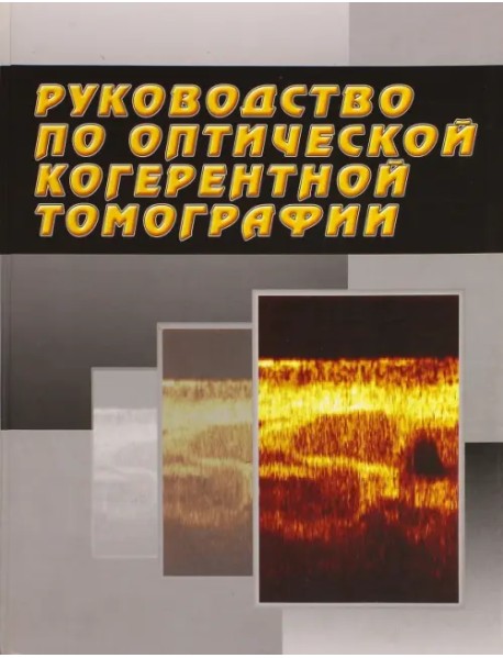 Руководство по оптической когерентной томографии