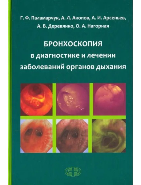 Бронхоскопия в диагностике и лечении заболеваний органов дыхания