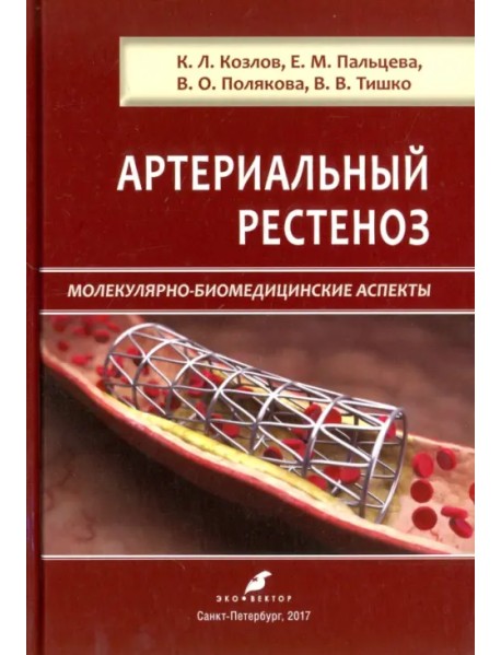 Артериальный рестеноз. Молекулярно-биомедицинские аспекты