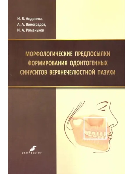 Морфологические предпосылки формирования одонтогенных синуситов верхнечелюстной пазухи