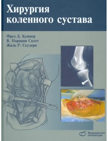 Хирургия коленного сустава