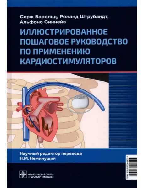 Иллюстрированное пошаговое руководство по применению кардиостимуляторов
