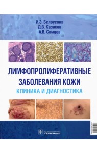Лимфопролиферативные заболеванания кожи. Клиника и диагностика