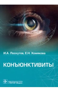 Конъюктивиты