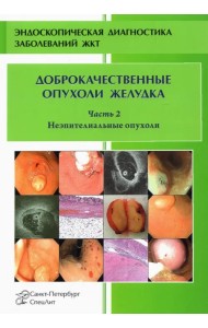 Доброкачественные опухоли желудка. Часть 2. Неэпителиальные опухоли