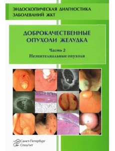 Доброкачественные опухоли желудка. Часть 2. Неэпителиальные опухоли Доброкачественные опухоли желудка. Часть 2. Неэпителиальные опухоли