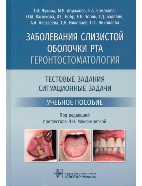 Заболевания слизистой оболочки рта. Геронтостоматология. Тестовые задания, ситуационные задачи