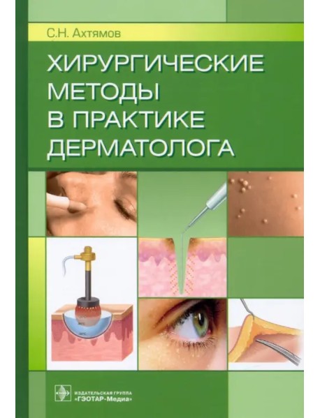 Хирургические методы в практике дерматолога