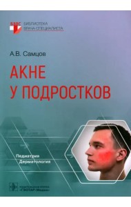 Акне у подростков. Руководство