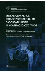 Индивидуальное эндопротезирование тазобедренного и коленного суставов