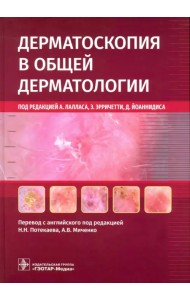 Дерматоскопия в общей дерматологии