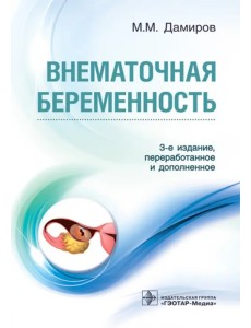 Внематочная беременность